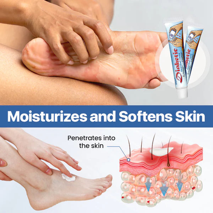 🥰𝑶𝒇𝒇𝒊𝒄𝒊𝒂𝒍 𝑺𝒕𝒐𝒓𝒆 |Final 2 hours 60% OFF:👩‍⚕️ZVAEVO® Diabetes Treatment Cream