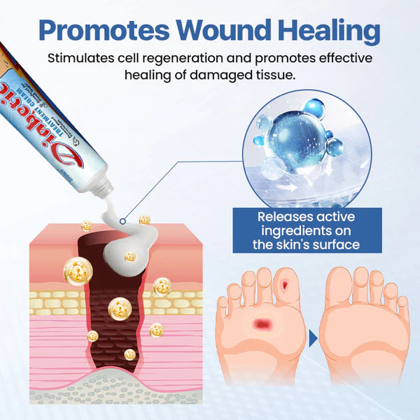 🥰𝑶𝒇𝒇𝒊𝒄𝒊𝒂𝒍 𝑺𝒕𝒐𝒓𝒆 |Final 2 hours 60% OFF:👩‍⚕️ZVAEVO® Diabetes Treatment Cream